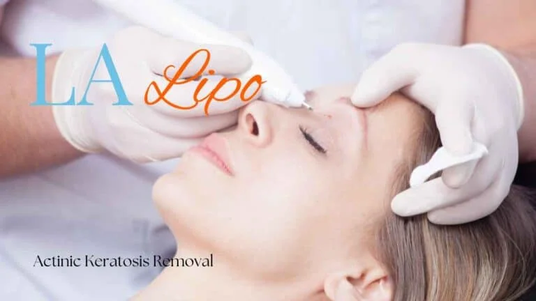 Woman receiving Actinic Keratosis Removal Treatment Congleton
