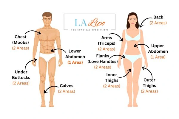 LA LIPO Cryolipolysis Areas Congleton