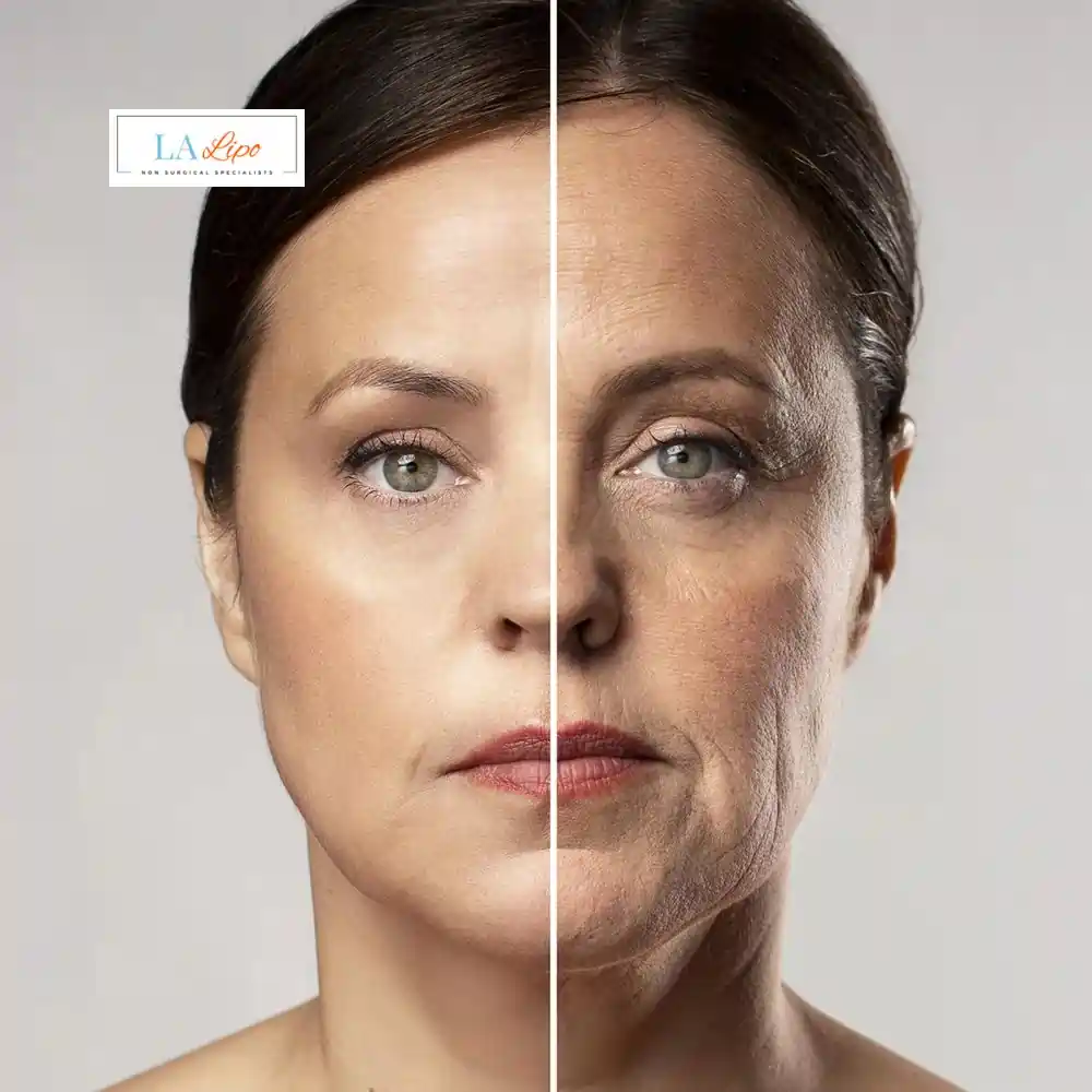 How Can You Tell If Non-Surgical Skin Tightening Is Right for You Congleton?