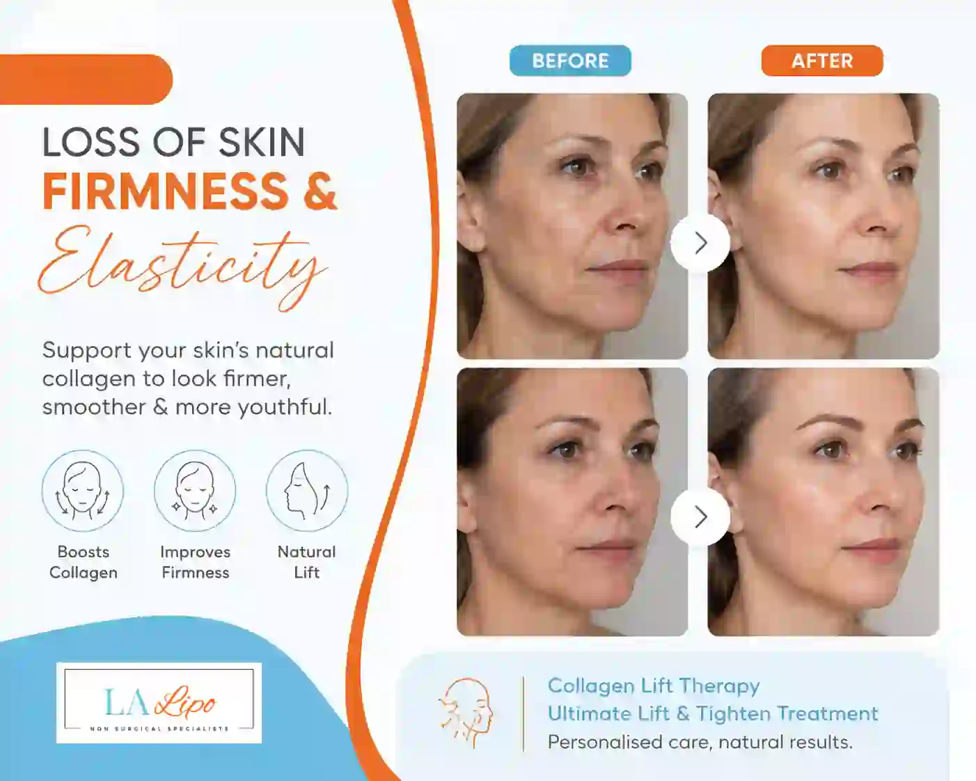 Sign #7: Loss of Skin Firmness and Elasticity Congleton