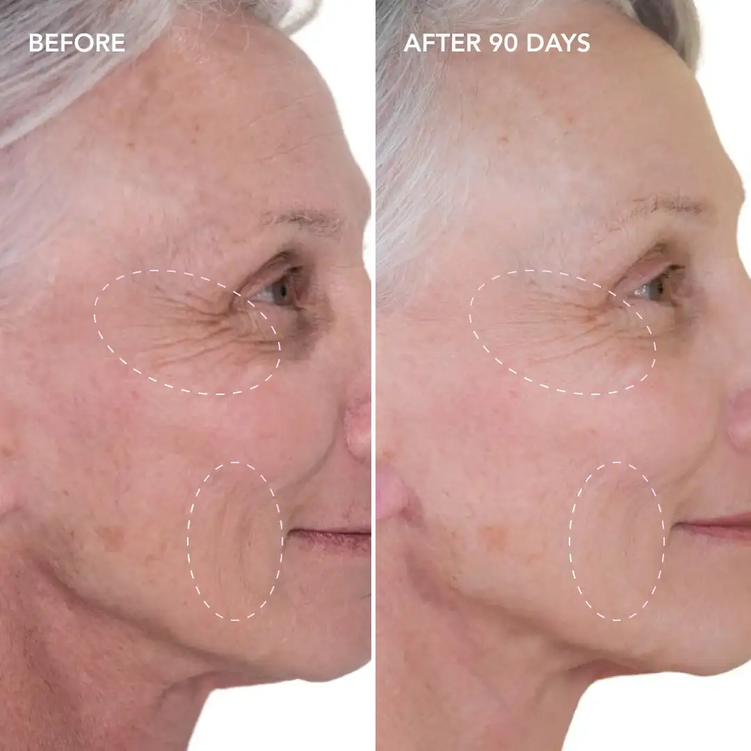 When will you see results Congleton